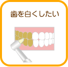 歯を白くしたい