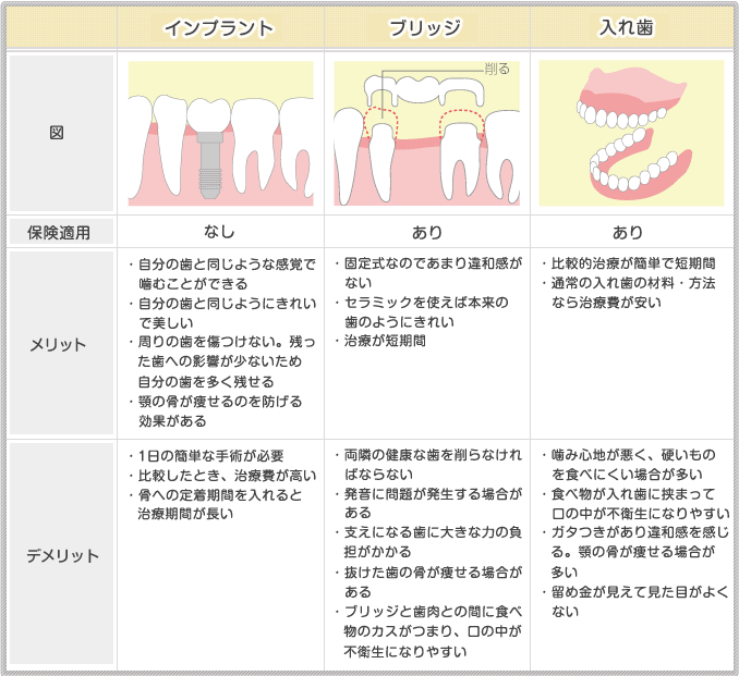 補綴治療の比較表